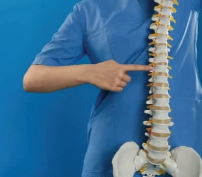 Stopiwch Ddyfalu, Dechreuwch Weld: Pam Mae Angen Ffordd Well i Sgrinio ar gyfer Scoliosis ar Eich...